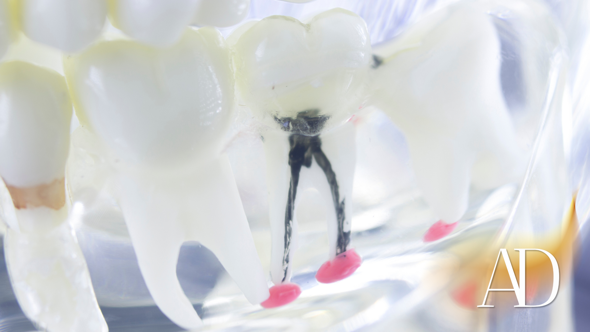 Close-up of white teeth with a small black-and-red dental model centered between them