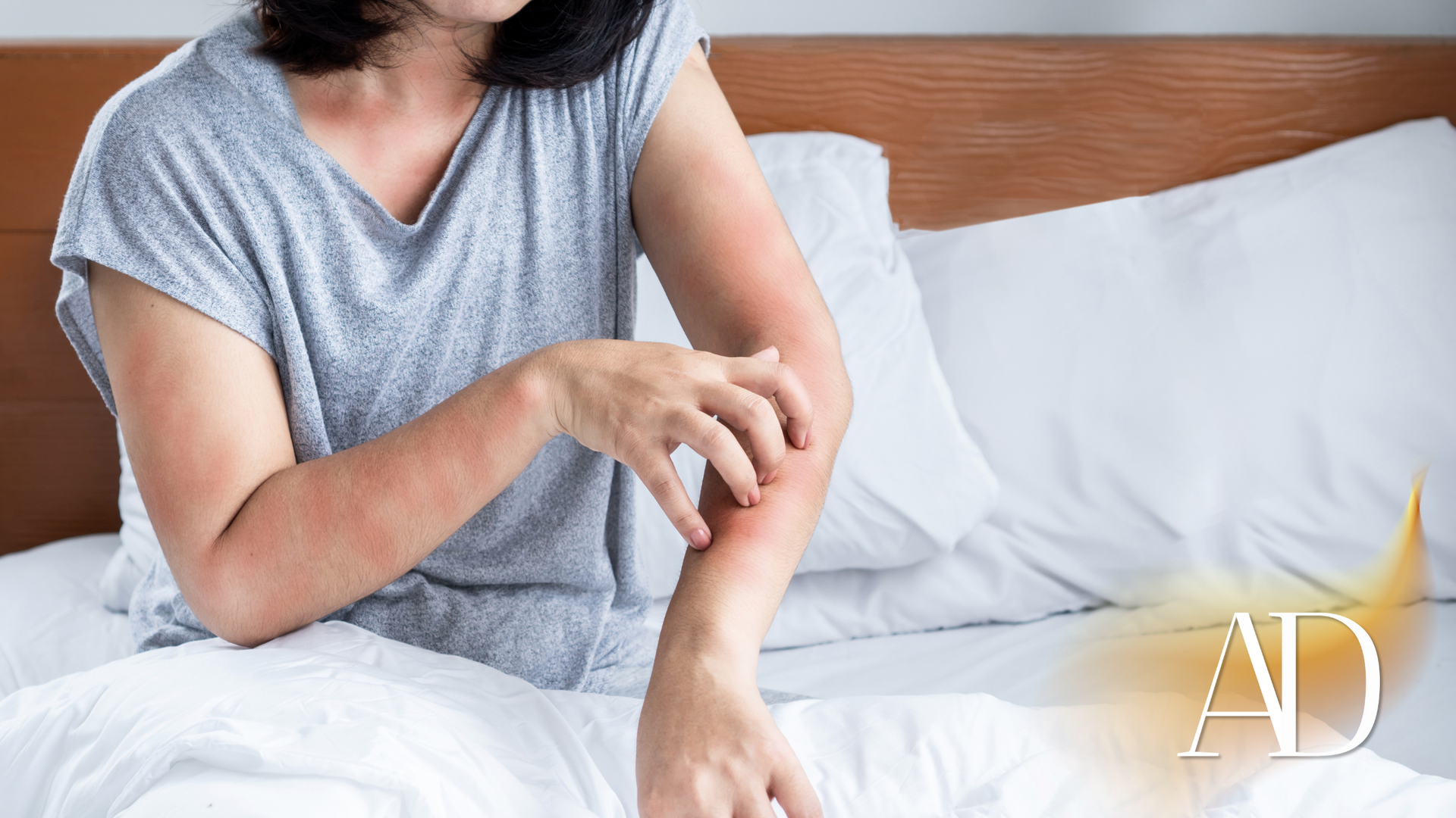 Person in a gray shirt scratching an arm while sitting on a bed with white pillows