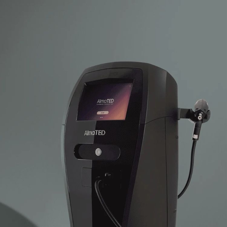 The Alma TED hair restoration device