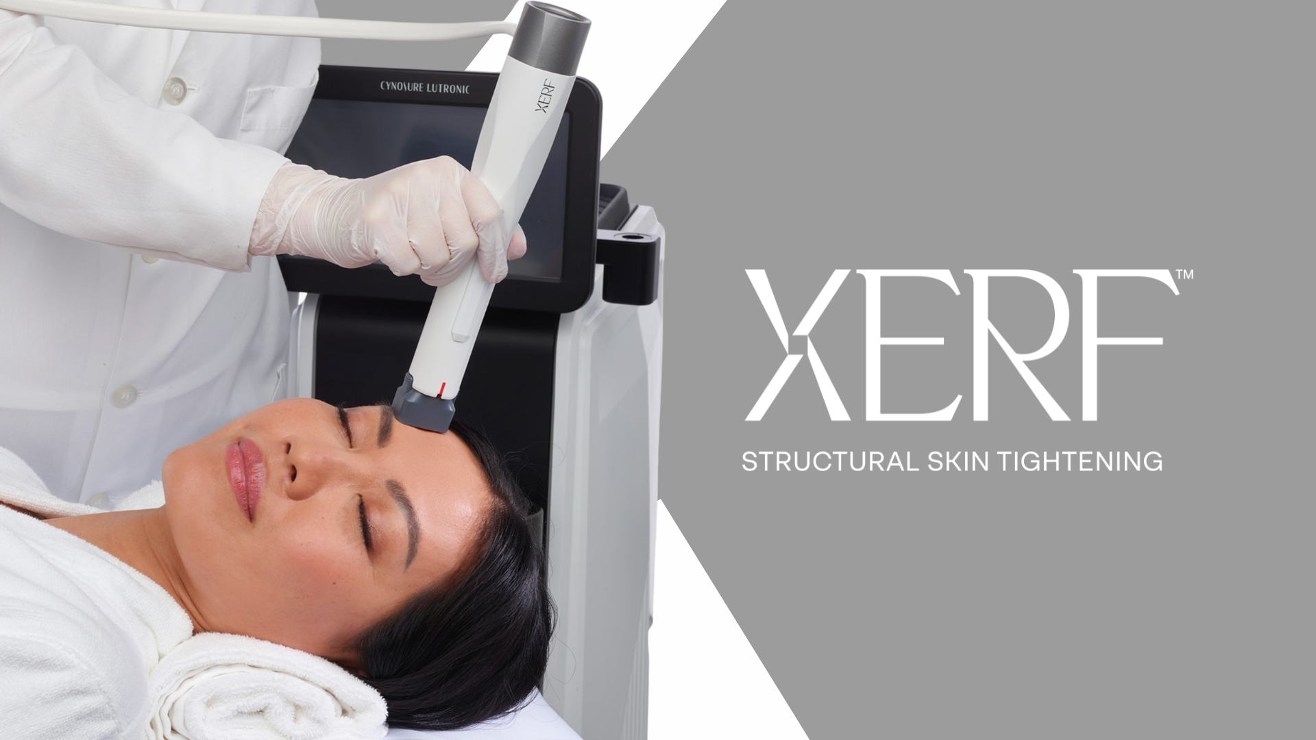 Una paciente recibiendo reafirmación estructural XERF en el rostro