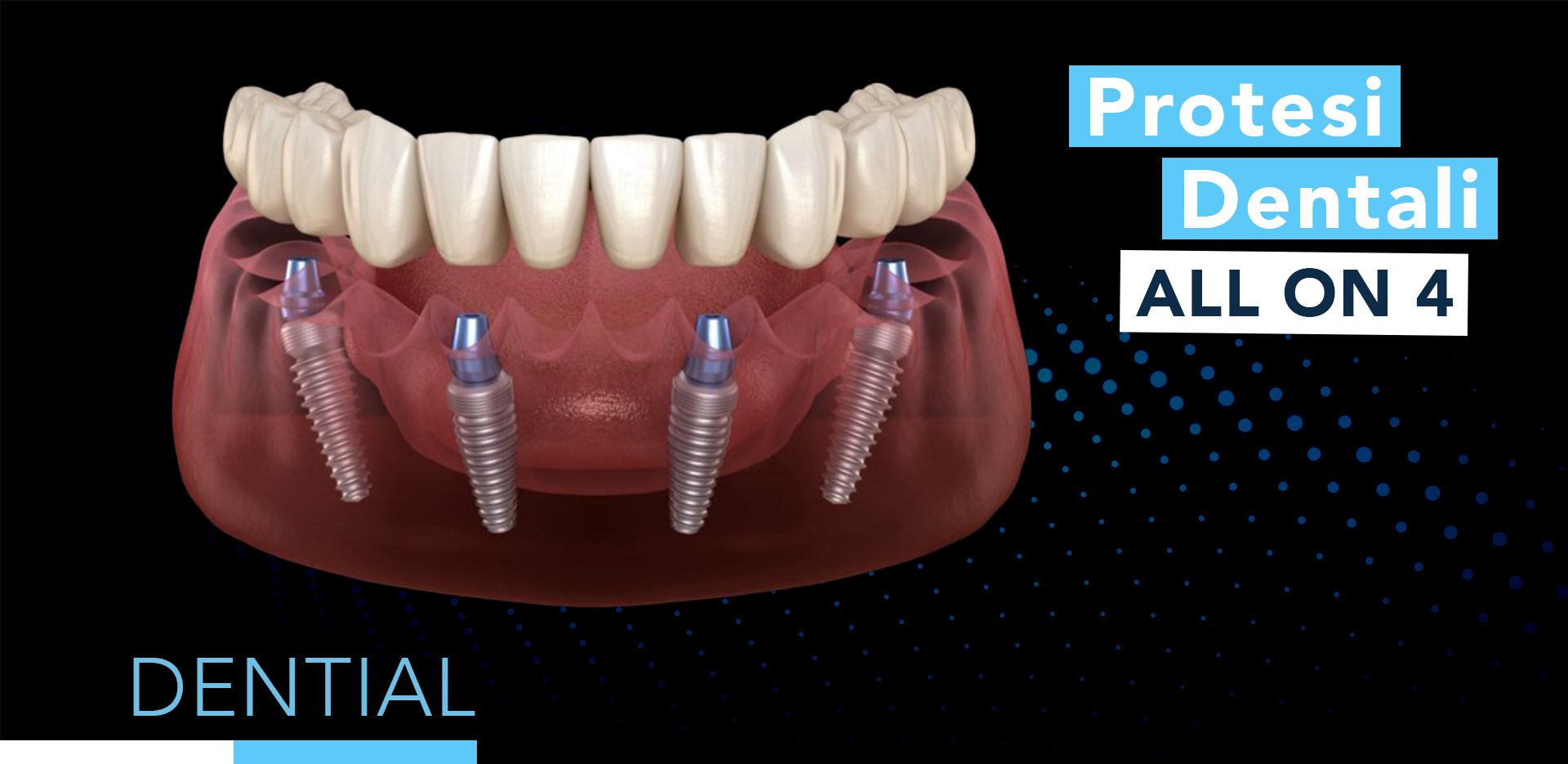Forbici SD A Per Lastre Termoplastiche - SCHEU-DENTAL - Foto 8