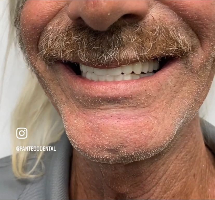 Smile