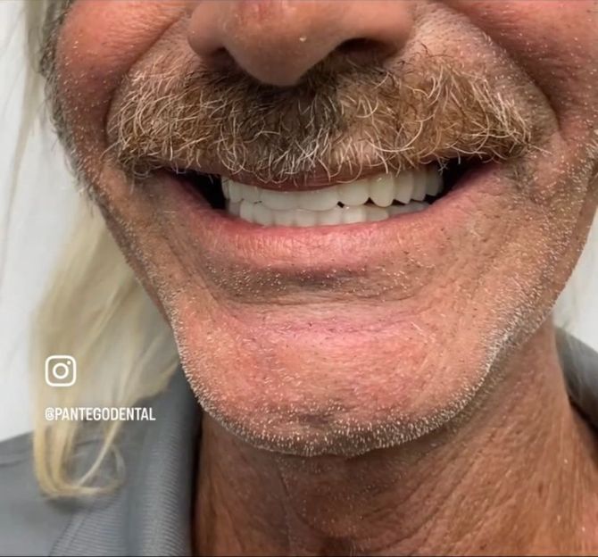 Smile