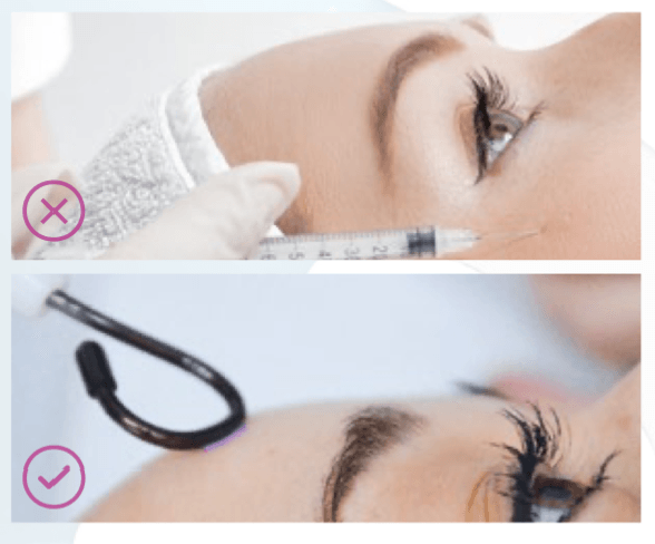 Una donna si sta facendo un'iniezione di botox sul viso