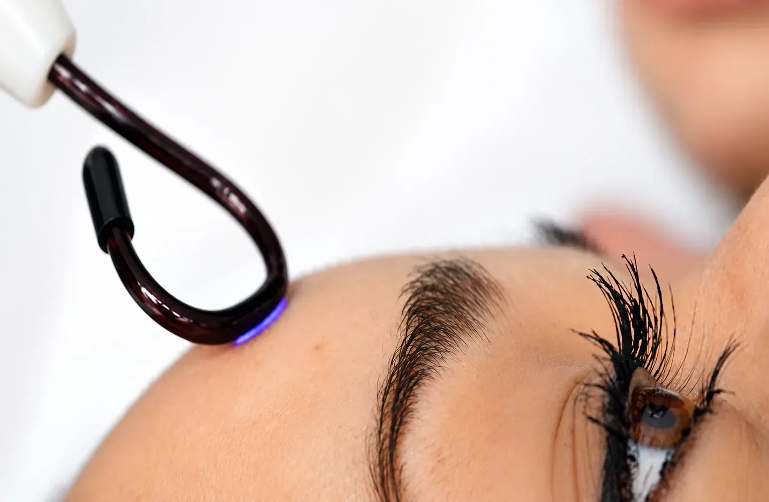Close-up of a face during eyebrow treatment with a heated tool near the brow