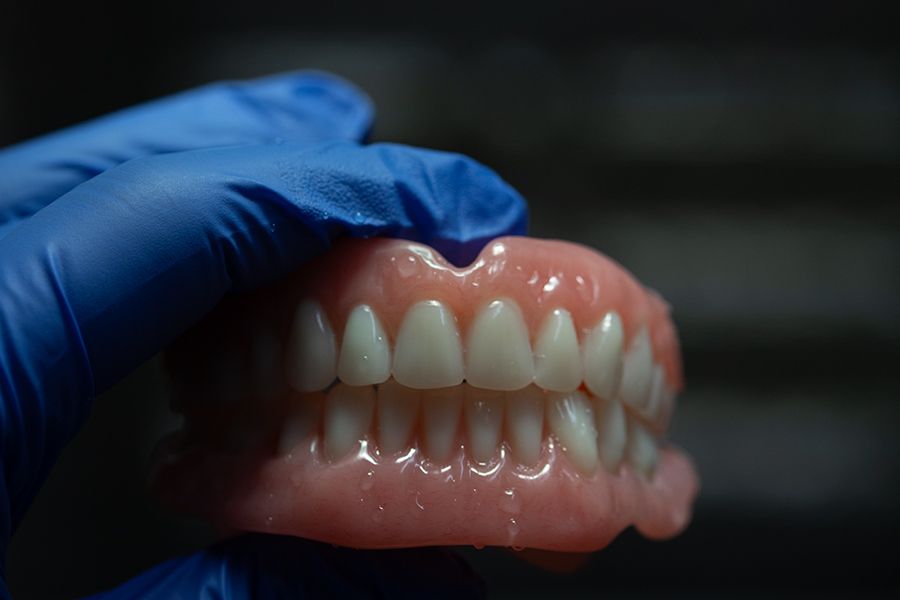 A Person Wearing Blue Gloves Is Holding a Denture in Their Hand — Cane to Coast Dentures in Sarina, QLD