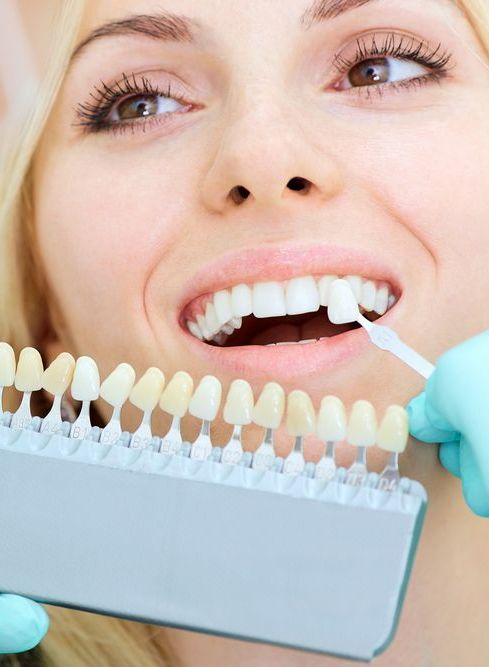 A Woman is Getting Her Teeth Whitened by a Dentist — Graham Johnson Dental Surgery In Beresfield, NSW