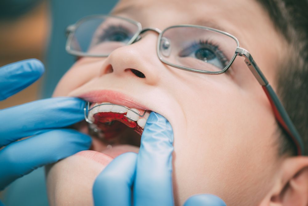 A Young Boy Wearing Glasses is Getting His Teeth Examined by a Dentist — Graham Johnson Dental Surgery In Beresfield, NSW