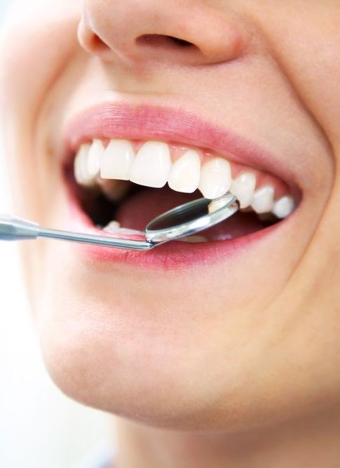 A Woman is Having Her Teeth Examined by a Dentist With a Mirror — Graham Johnson Dental Surgery In Beresfield, NSW