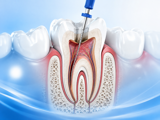 endodonzia