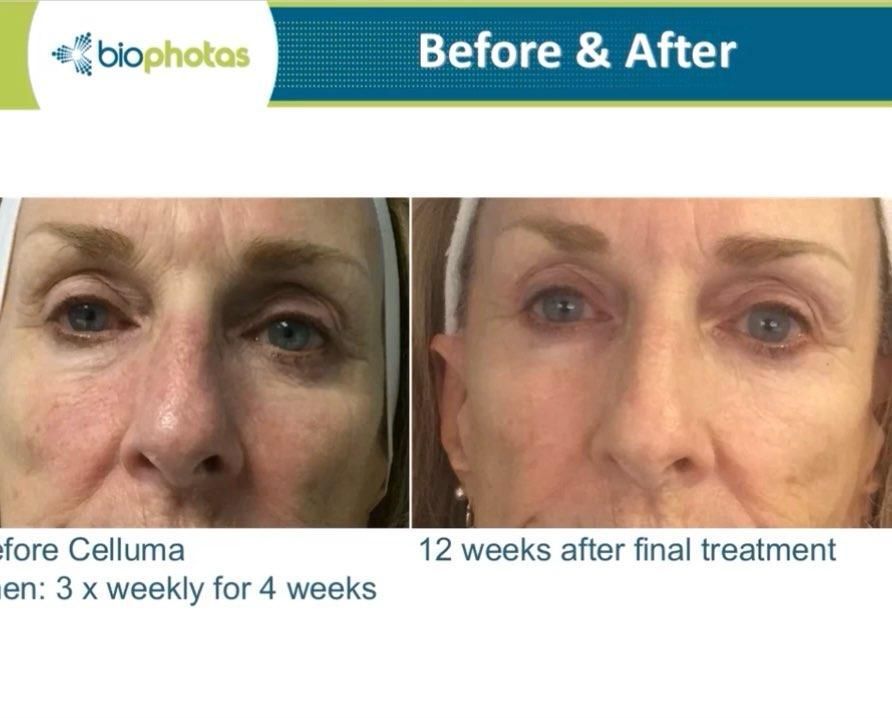 Side-by-side comparison: Before and after skin treatment. The 