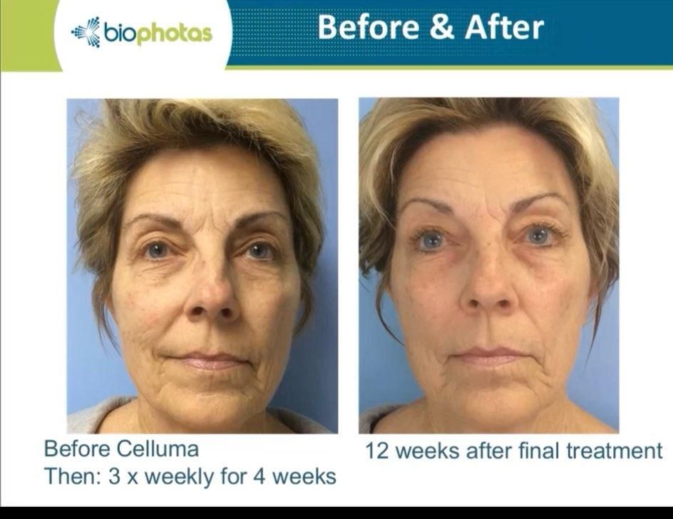 A before and after comparison of a woman's face, with the 