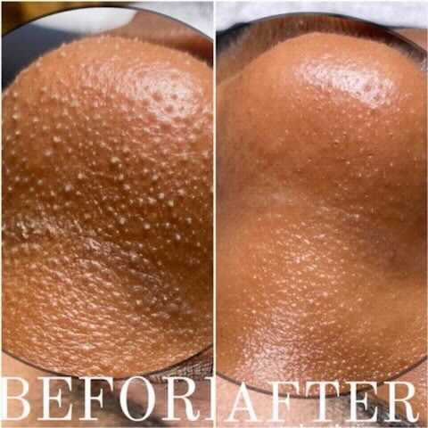 Side-by-side comparison of skin. The 