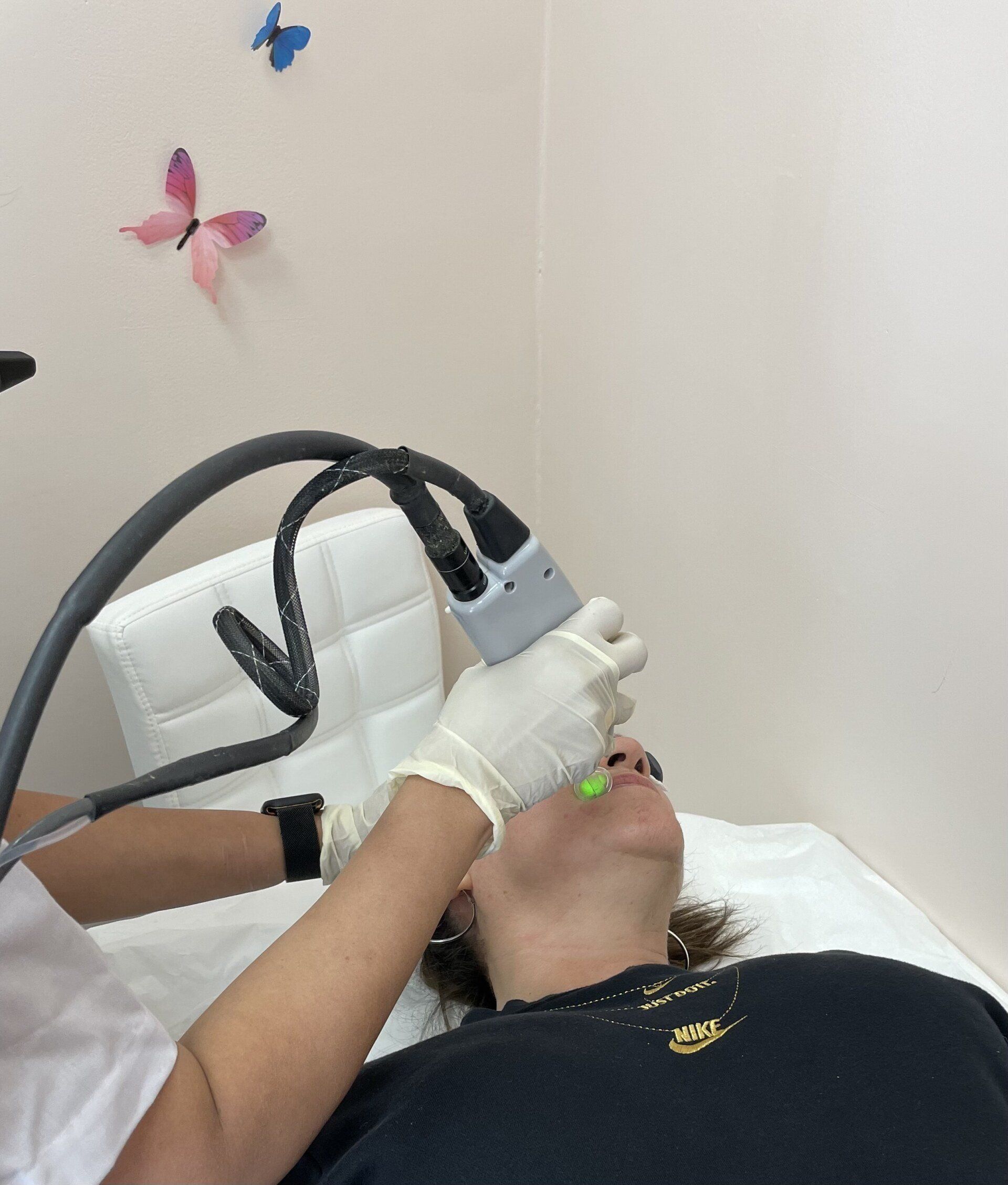Person receiving facial laser treatment in a medical setting; handheld device emits green light.