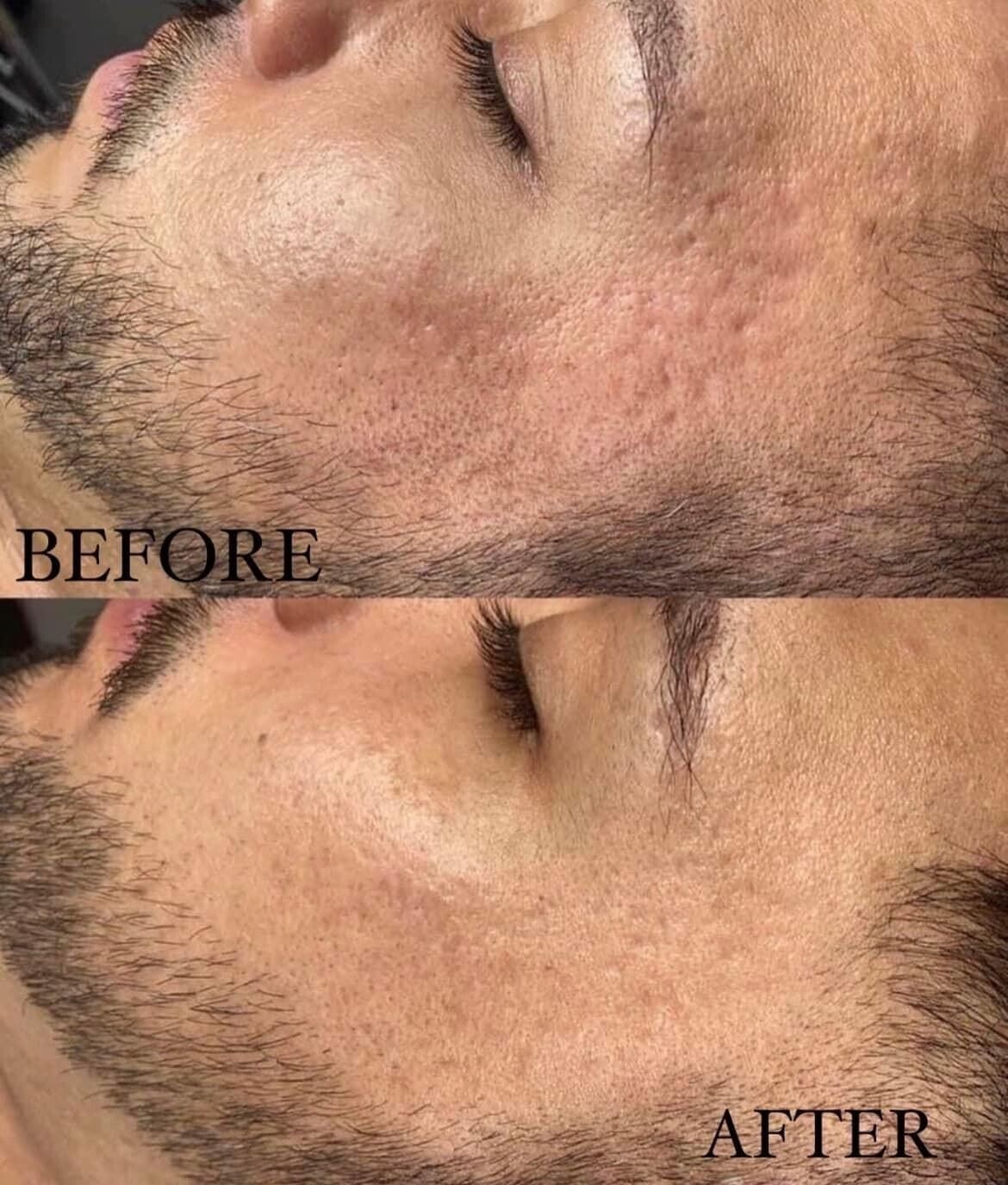 Comparison of skin: 