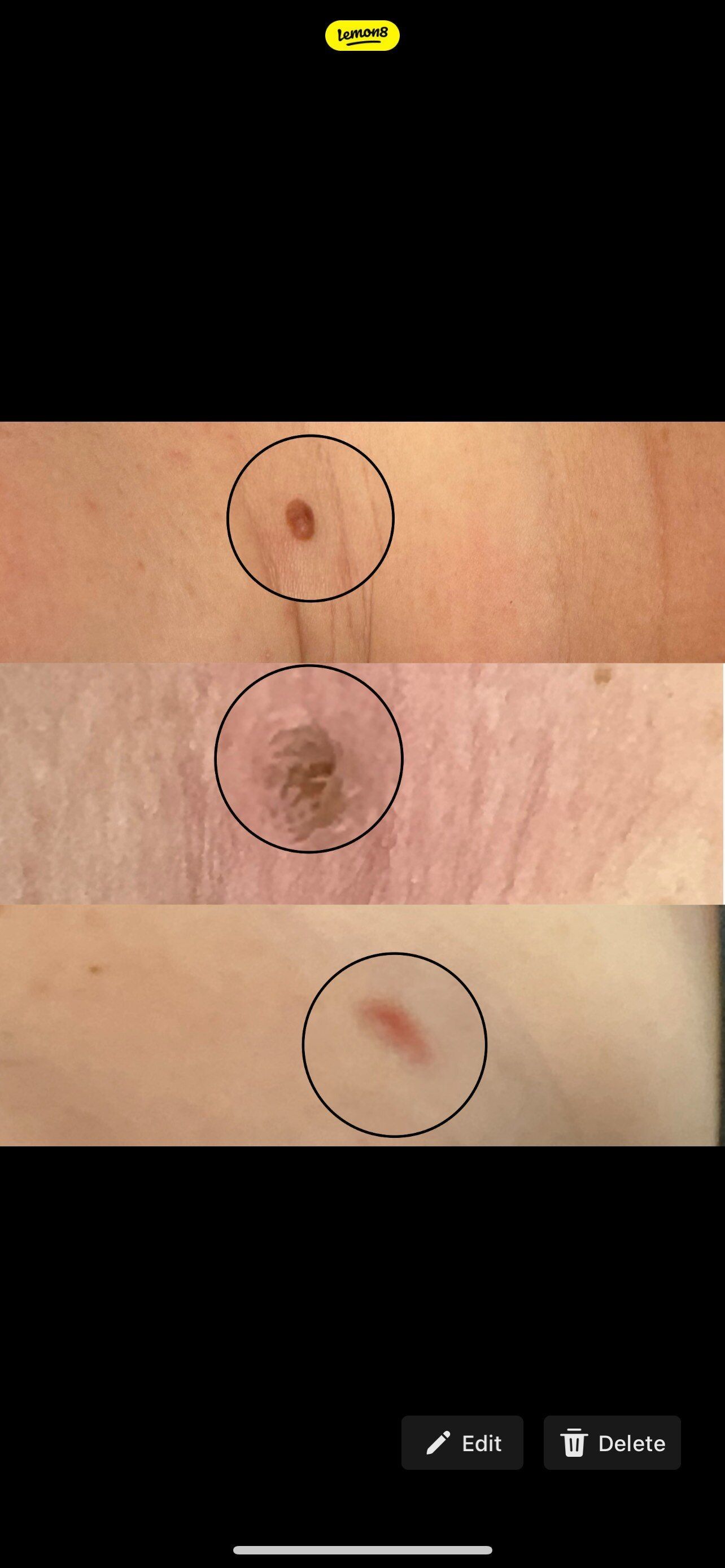 Three skin lesions circled for examination.