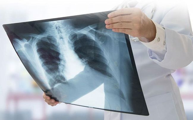 DR. CARLOS ALBERTO GÓMEZ ZAMORA - Neumólogo internista