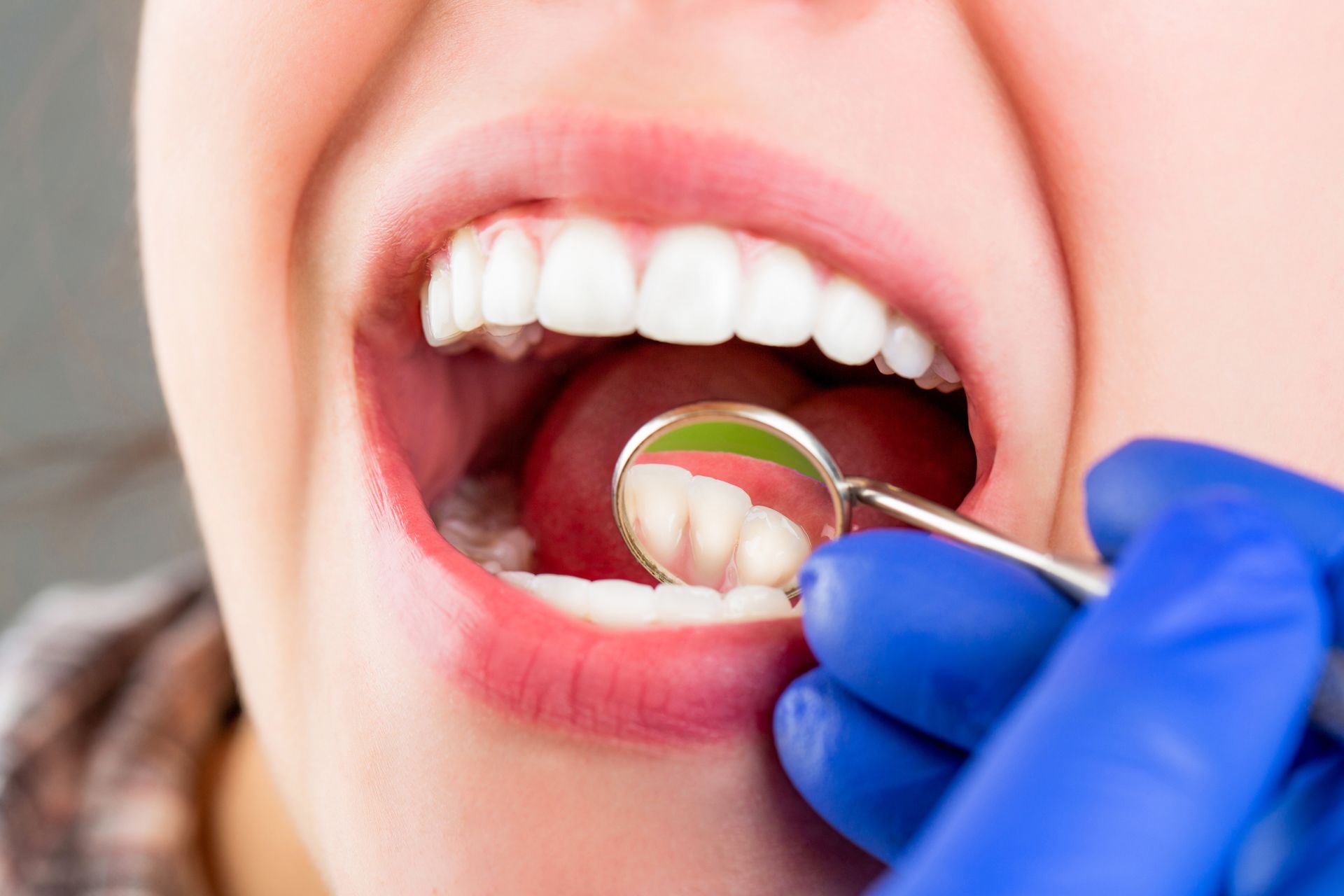 A close-up of a general dentist performing an examination on a patient's teeth. A close-up of a general dentist performing an examination on a patient's teeth.