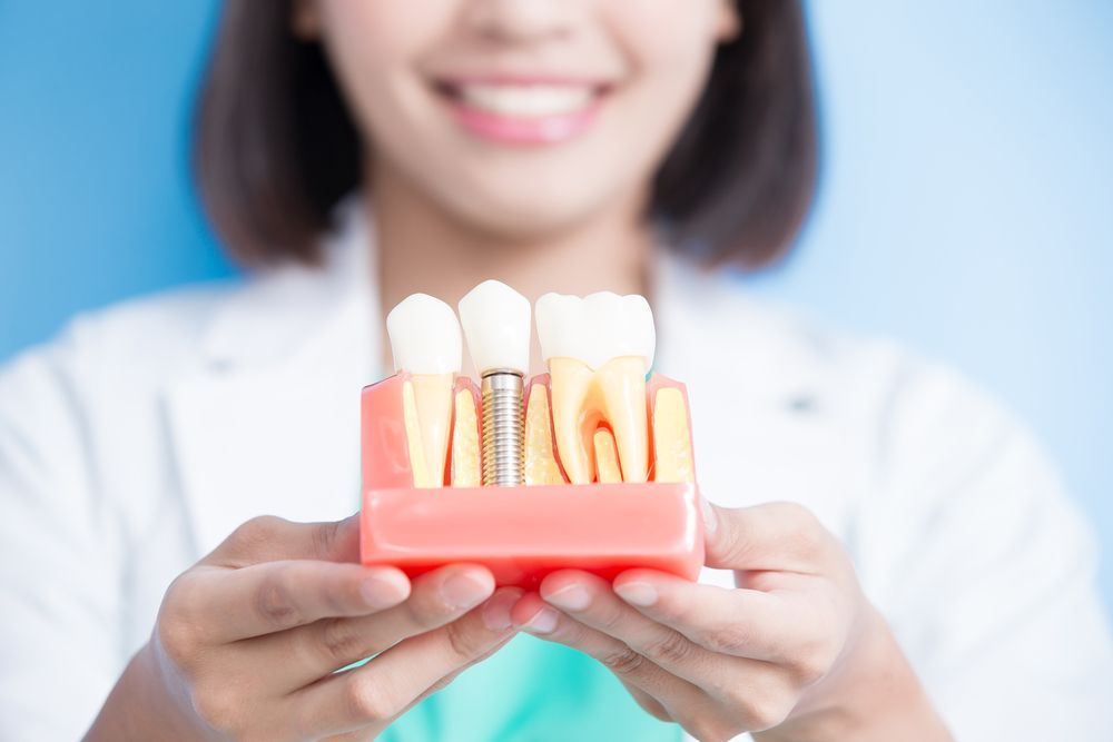 A Woman is Holding a Model of Dental Implants in Her Hands — Dental Prosthetics By Richard & Cindy In Oxenford, QLD