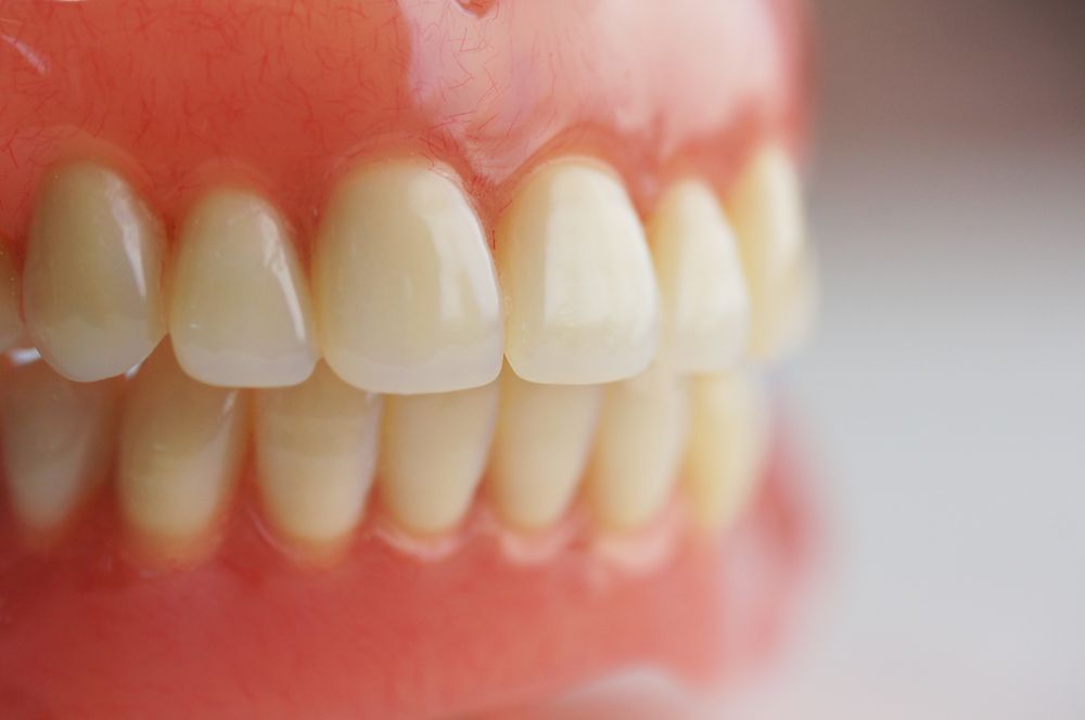 Set of Upper and Lower Dentures