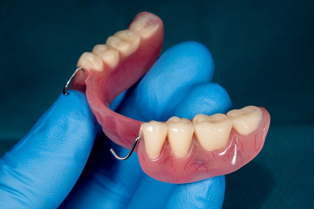 implant denture