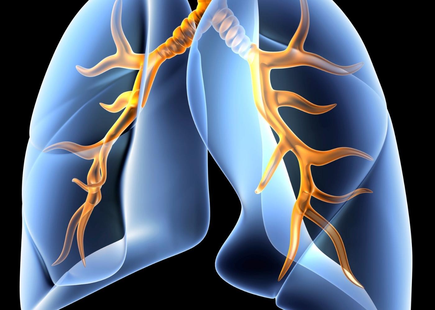 neumologia alta especialidad