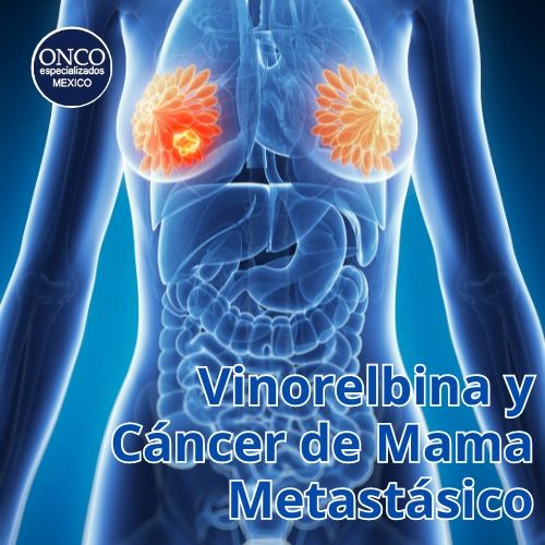 el uso de vinorelbina en cáncer de mama metastásico.