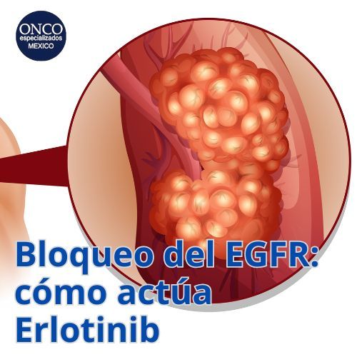 Imagen microscópica de células bloqueadas por Erlotinib.