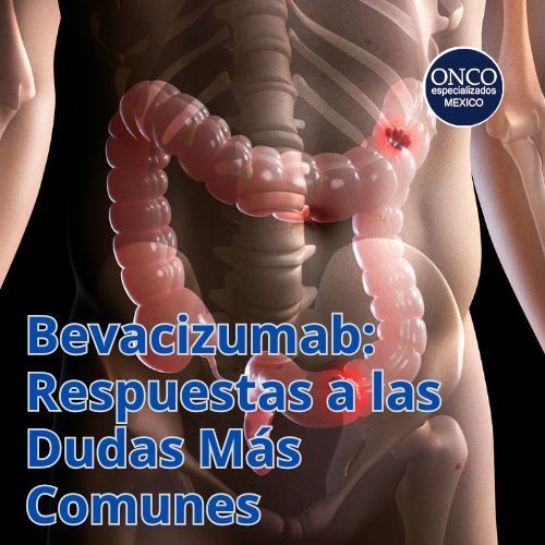 Colon y abdomen con texto: “Bevacizumab: Respuestas a las Dudas Más Comunes”