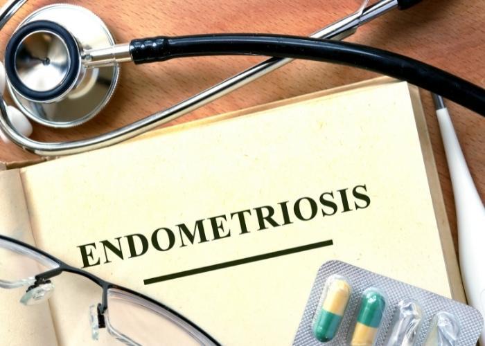 Endometriosis escrita en una nota con un estetoscopio y cápsulas de medicamentos cerca.