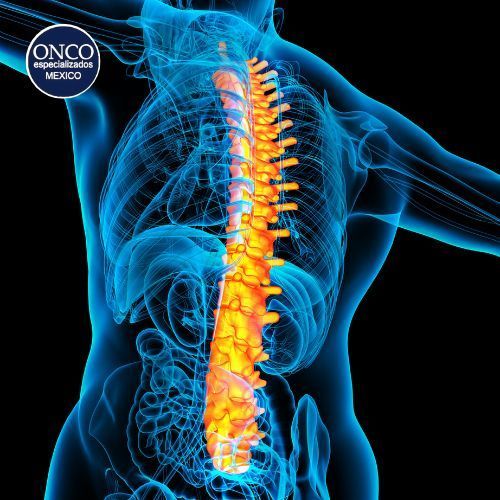 Columna inflamada por espondilitis.