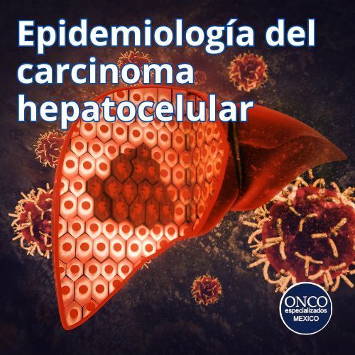 Hígado con células tumorales destacando la epidemiología del carcinoma hepatocelular