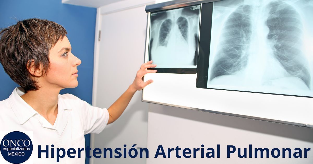 Bosentan - Información y Precios Actualizados