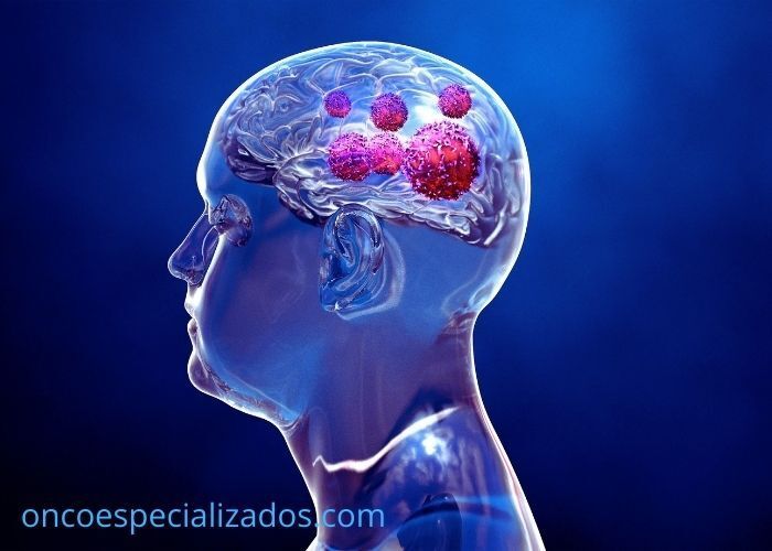 cerebro tumores