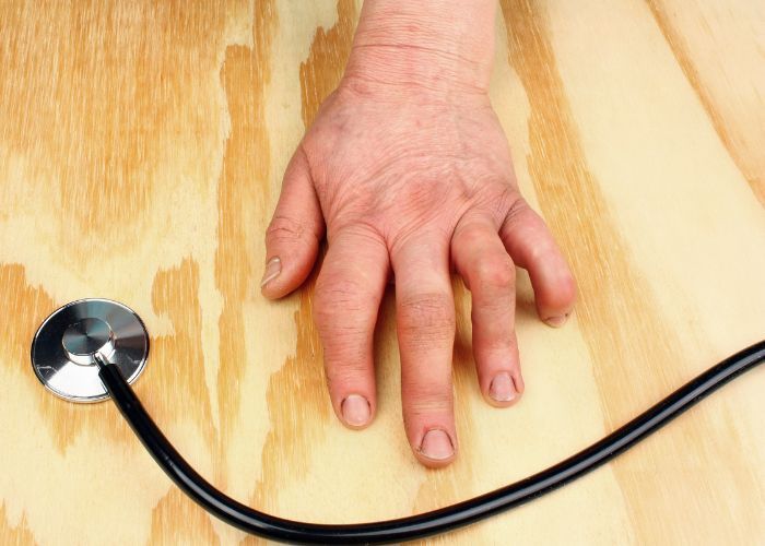 doctor artritis