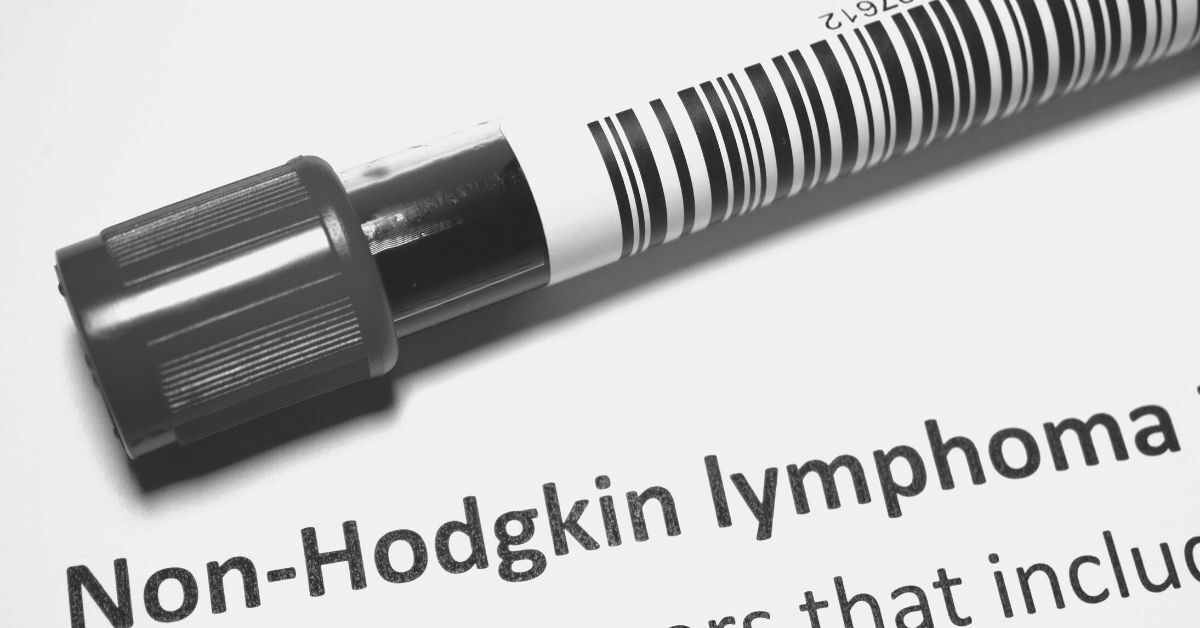 Tubo de ensayo con sangre y etiqueta médica de linfoma no Hodgkin