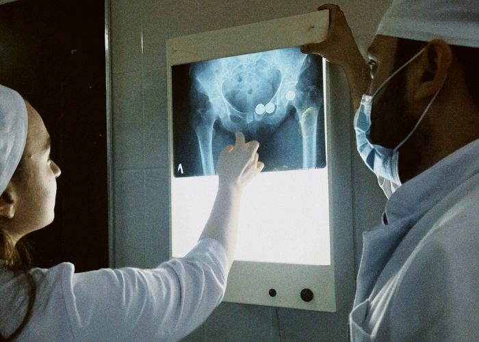 Ibrutinib costo ibrutinib precio mexico