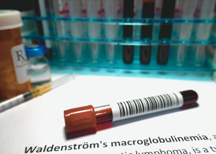 macro ibrutinib