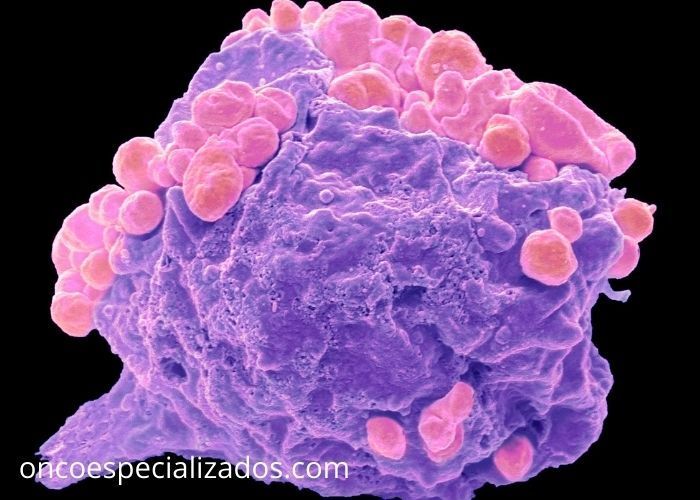 Qué es la Neoplasia