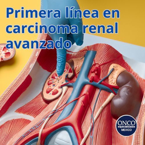Ilustración del riñón humano con enfoque médico.