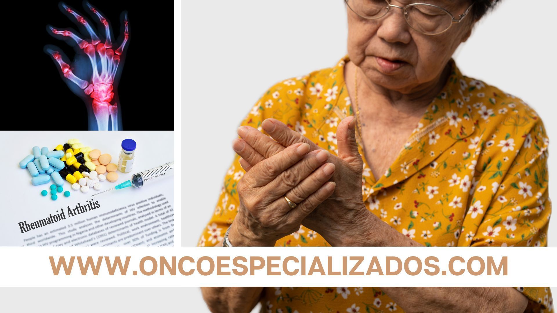 tratamiento aubagio aubagio precio
