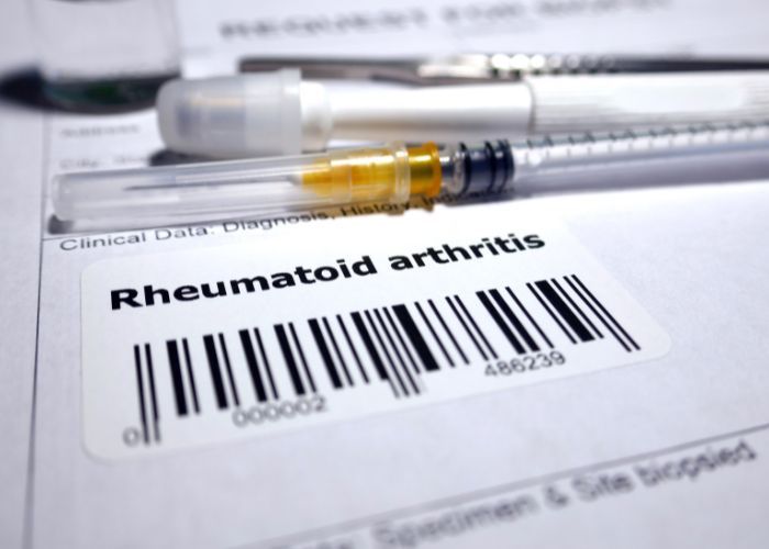 tratamiento medico con rituximab