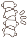 braunes, strichgezeichnetes Symbol einer menschlichen Wirbelsäule mit einer Krümmung und Markierungen, die Schmerzen zeigen