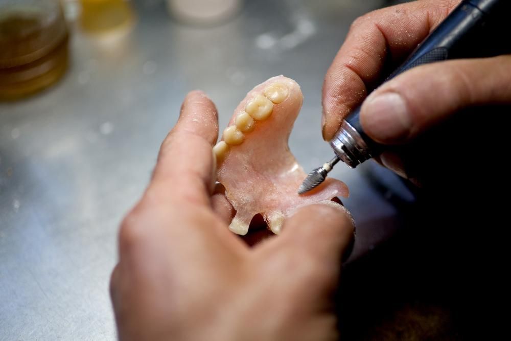 A Person Is Working on A Denture with A Machine — Cosmetic Denture Services–Jacob Maxwell in Moranbah, QLD