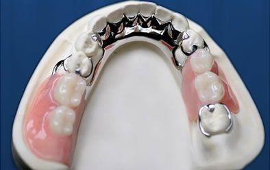 A Denture And A Dental Mirror On A White Surface — Cosmetic Denture Services–Jacob Maxwell in Sarina, QLD