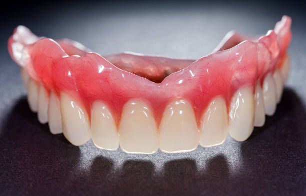 Close Up of a Denture With White Teeth and Red Gums on a Black Surface — Cosmetic Denture Services–Jacob Maxwell in Proserpine, QLD