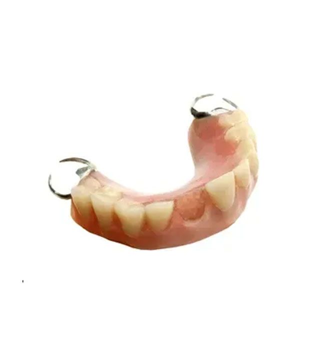Close Up of a Denture — Cosmetic Denture Services–Jacob Maxwell in Moranbah, QLD