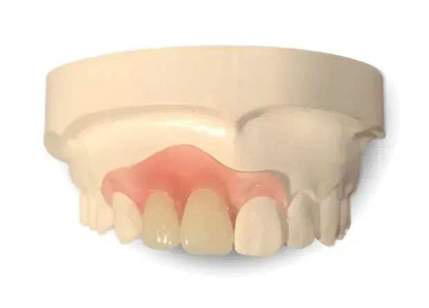 Elegant Denture — Cosmetic Denture Services–Jacob Maxwell in Proserpine, QLD