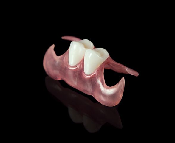 Close Up of a Denture — Cosmetic Denture Services–Jacob Maxwell in Moranbah, QLD