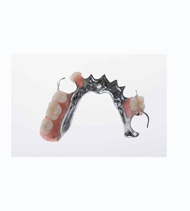 Close Up of a Partial Denture on a White Surface — Cosmetic Denture Services–Jacob Maxwell in Mackay, QLD